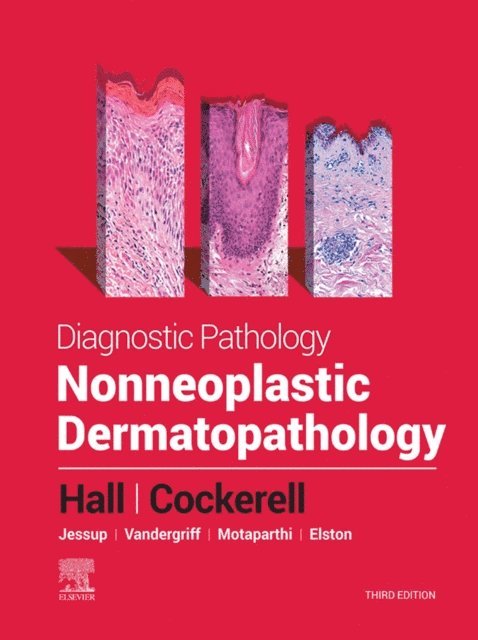 Brian J. Hall - Diagnostic Pathology: Nonneoplastic Dermatopathology - E-Book, E-bok
