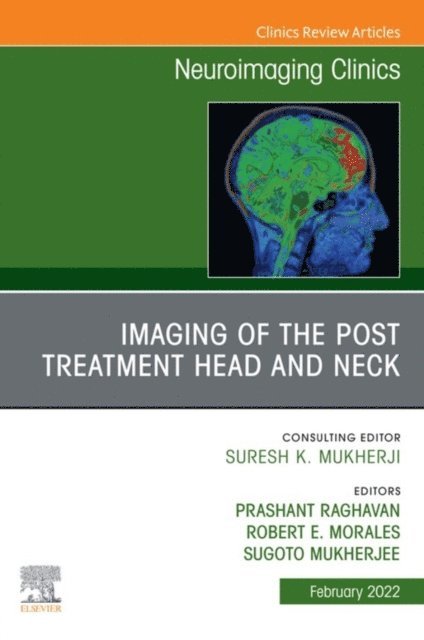 Sugoto Mukherjee, Robert E. Morales, Prashant Raghavan - Imaging of the Post Treatment Head and Neck, An Issue of Neuroimaging Clinics of North America, E-Book, E-bok