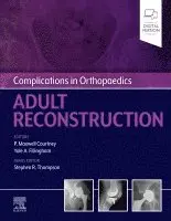 Paul Maxwell Courtney, Yale A. Fillingham - Complications in Orthopaedics: Adult Reconstruction, Inbunden