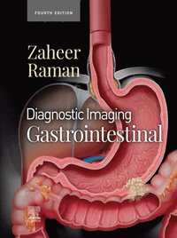 Diagnostic Imaging: Gastrointestinal - E-Book