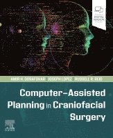 Amir H. Dorafshar, Joseph Lopez, Russell R. Reid - Computer-Assisted Planning in Craniofacial Surgery, Häftad