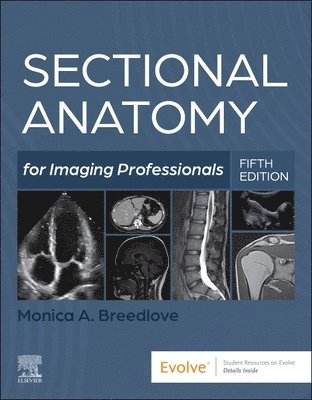 Monica Breedlove - Sectional Anatomy for Imaging Professionals, Häftad
