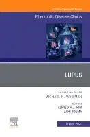 Zahi Touma, Alfred Kim - Lupus, An Issue of Rheumatic Disease Clinics of North America, Inbunden. Tillgänglighet: Lägg i varukorg