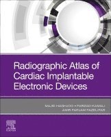 Majid Haghjoo, Farzad Kamali, Amirfarjam Fazelifar - Radiographic Atlas of Cardiac Implantable Electronic Devices, Häftad. Tillgänglighet: Lägg i varukorg