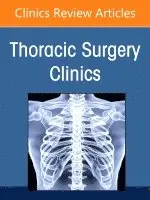 Esophageal Cancer, An Issue of Thoracic Surgery Clinics