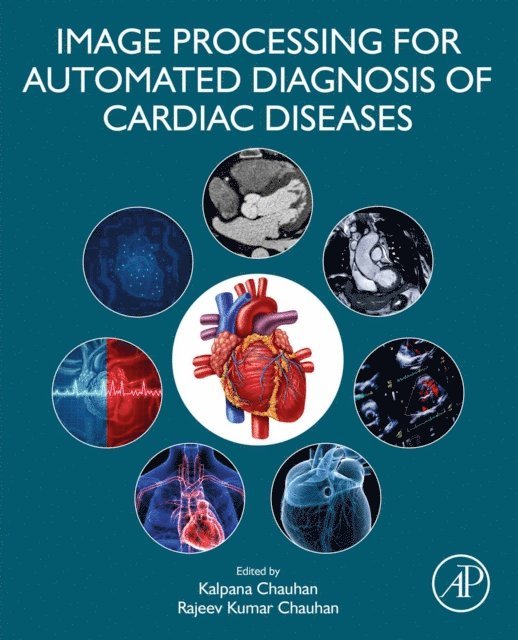 Rajeev Kumar Chauhan, Kalpana Chauhan - Image Processing for Automated Diagnosis of Cardiac Diseases, E-bok