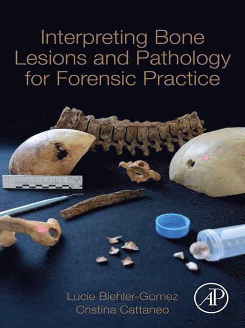 Cristina Cattaneo, Lucie Biehler-Gomez - Interpreting Bone Lesions and Pathology for Forensic Practice, E-bok