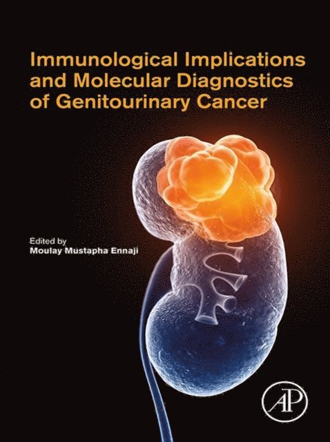 Moulay Mustapha Ennaji - Immunological Implications and Molecular Diagnostics of Genitourinary Cancer, E-bok