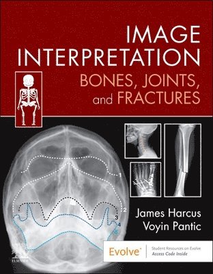 James Harcus, Voyin Pantic - Image Interpretation: Bones, Joints, and Fractures, Häftad. Tillgänglighet: Lägg i varukorg