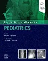 Matthew Schmitz - Complications in Orthopaedics: Pediatrics, Inbunden