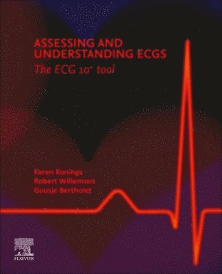 Assessing and Understanding ECGs: The ECG10+ tool