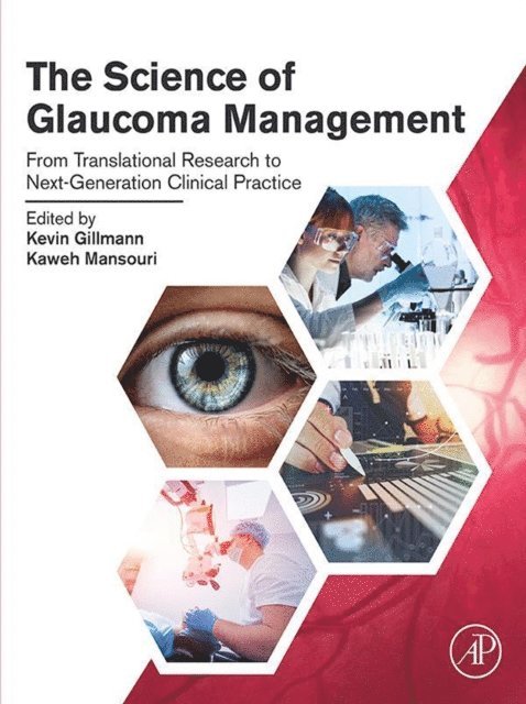 Kaweh Mansouri, Kevin Gillmann - Science of Glaucoma Management, E-bok. Tillgänglighet: Lägg i varukorg
