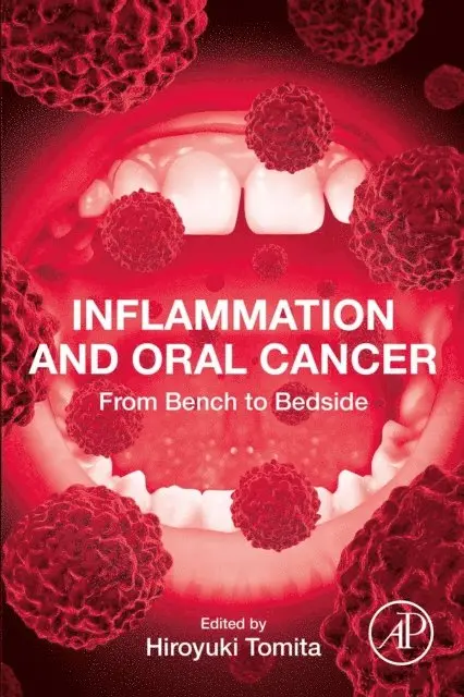 Hiroyuki Tomita - Inflammation and Oral Cancer, E-bok. Tillgänglighet: Lägg i varukorg