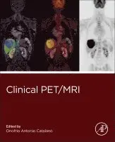 Onofrio Antonio Catalano - Clinical PET/MRI, Häftad. Tillgänglighet: Lägg i varukorg