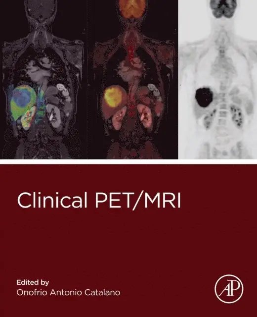 Onofrio Antonio Catalano - Clinical PET/MRI, E-bok. Tillgänglighet: Lägg i varukorg