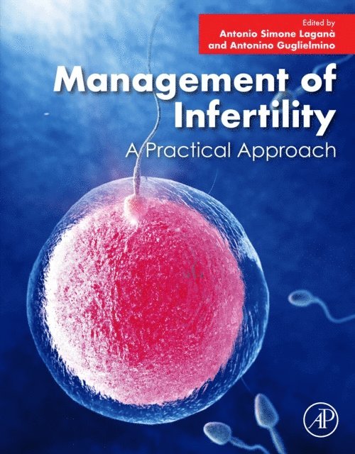 Antonino Guglielmino, Antonio Simone Lagana - Management of Infertility, E-bok