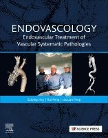 Zaiping Jing, Rui Feng, Jiaxuan Feng - Endovascology, Häftad. Tillgänglighet: Kommande