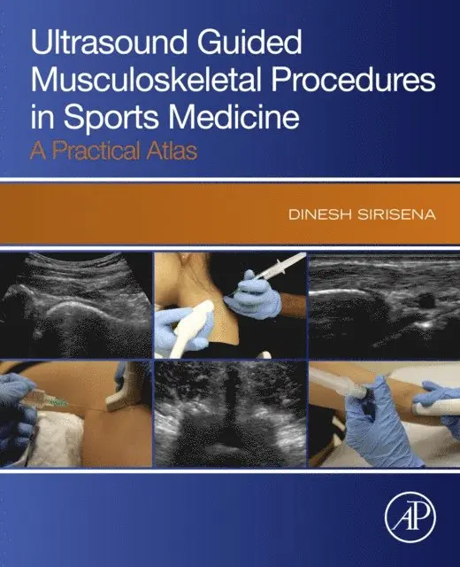 Dinesh Sirisena - Ultrasound Guided Musculoskeletal Procedures in Sports Medicine, E-bok. Tillgänglighet: Lägg i varukorg