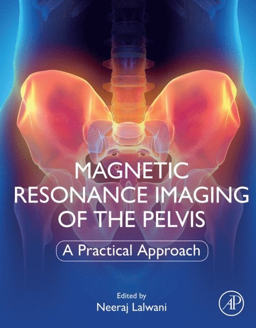 Neeraj Lalwani - Magnetic Resonance Imaging of The Pelvis, E-bok