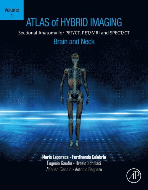 Antonio Bagnato, Alfonso Ciaccio, Orazio Schillaci, Eugenio Gaudio, Ferdinando Calabria, Mario Leporace - Atlas of Hybrid Imaging Sectional Anatomy for PET/CT, PET/MRI and SPECT/CT Vol. 1: Brain and Neck, E-bok