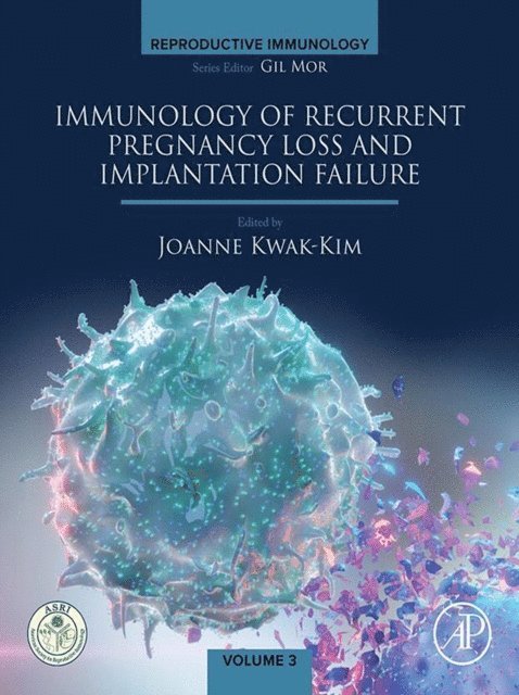Joanna Kwak-Kim - Immunology of Recurrent Pregnancy Loss and Implantation Failure, E-bok
