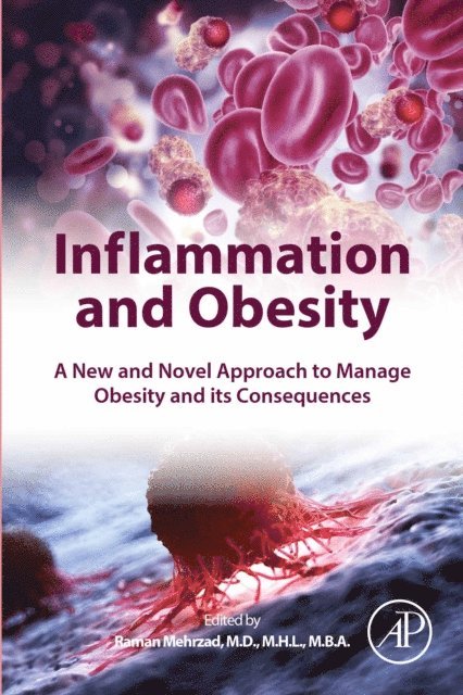 Raman Mehrzad - Inflammation and Obesity, E-bok