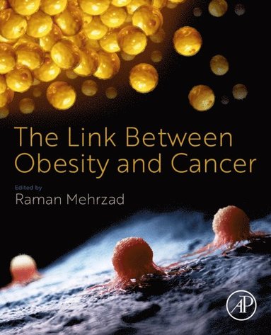 Raman Mehrzad - Link Between Obesity and Cancer, E-bok