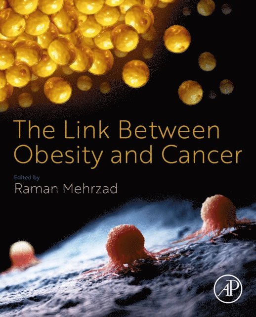 Raman Mehrzad - Link Between Obesity and Cancer, E-bok