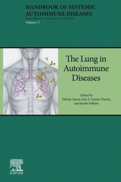 Jacobo Sellares, Jose Gomez-Puerta, Fabiola Atzeni - Lung in Autoimmune Diseases, E-bok