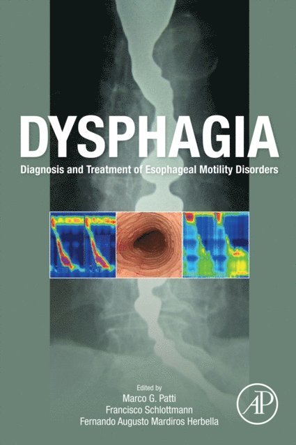 Fernando Augusto Mardiros Herbella, Francisco Schlottmann, Marco G. Patti - Dysphagia, E-bok