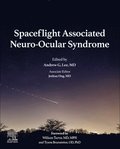 Spaceflight Associated Neuro-Ocular Syndrome