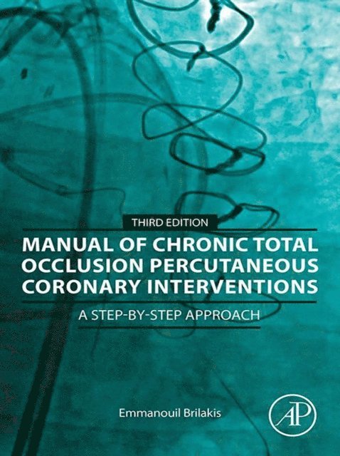 Emmanouil Brilakis - Manual of Chronic Total Occlusion Percutaneous Coronary Interventions, E-bok. Tillgänglighet: Lägg i varukorg