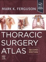 Mark K. Ferguson - Thoracic Surgery Atlas, Inbunden