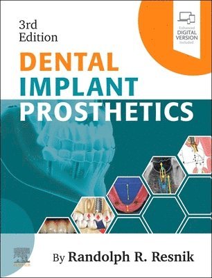 Randolph Resnik - Dental Implant Prosthetics, Inbunden. Tillgänglighet: Kommande