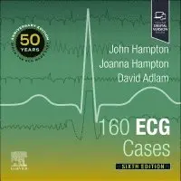 160 ECG Cases