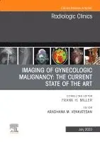 Imaging of Gynecologic Malignancy: The Current State of the Art, An Issue of Radiologic Clinics of North America