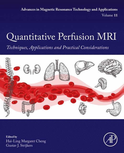 ?Gustav J. Strijkers?, Hai-Ling Margaret Cheng - Quantitative Perfusion MRI, E-bok