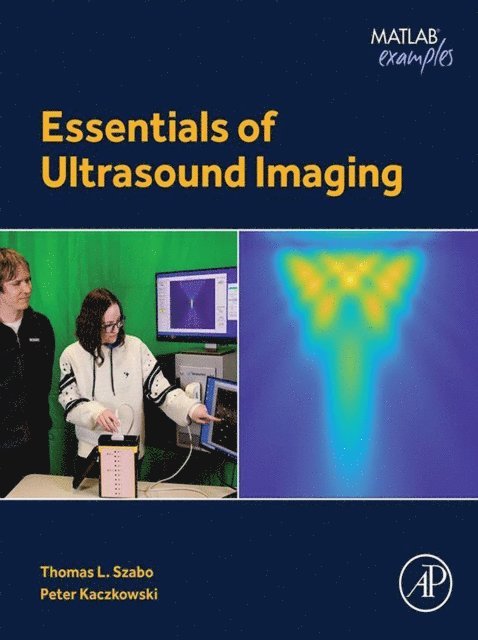 Peter Kaczkowski, Thomas L. Szabo - Essentials of Ultrasound Imaging, E-bok