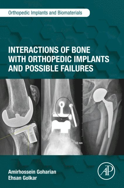 Ehsan Golkar, Amirhossein Goharian - Interactions of Bone with Orthopedic Implants and Possible Failures, E-bok
