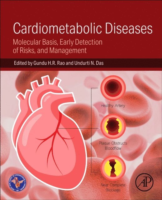 Undurti N. Das, Gundu H. R. Rao - Cardiometabolic Diseases, E-bok