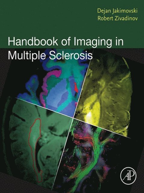 Robert Zivadinov, Dejan Jakimovski - Handbook of Imaging in Multiple Sclerosis, E-bok. Tillgänglighet: Lägg i varukorg