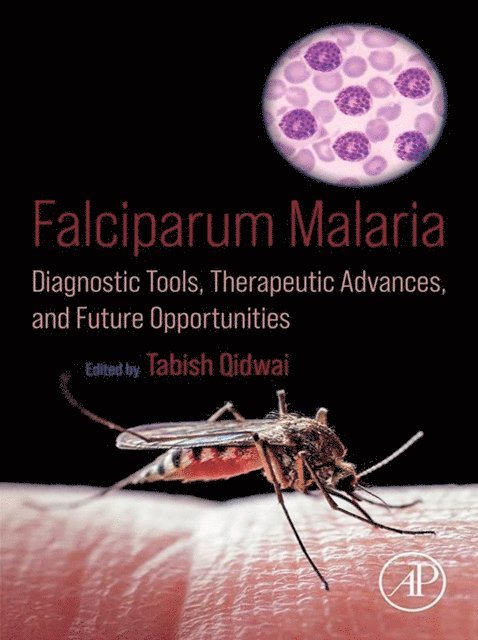 Tabish Qidwai - Falciparum Malaria, E-bok. Tillgänglighet: Lägg i varukorg