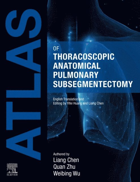 Weibing Wu, Quan Zhu, Liang Chen - Atlas of Thoracoscopic Anatomical Pulmonary Subsegmentectomy, E-bok