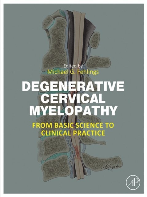 Michael G. Fehlings - Degenerative Cervical Myelopathy, E-bok