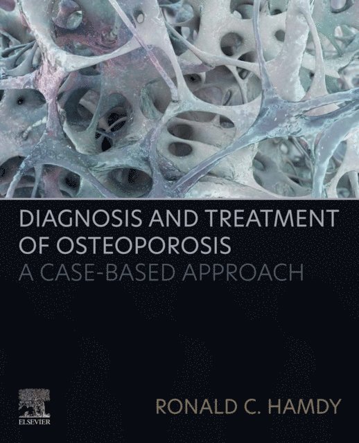Ronald C. Hamdy - Diagnosis and Treatment of Osteoporosis, E-bok
