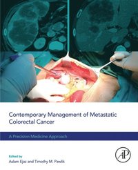 Contemporary Management of Metastatic Colorectal Cancer
