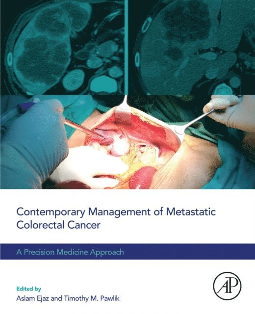 Timothy M. Pawlik, Aslam Ejaz - Contemporary Management of Metastatic Colorectal Cancer, E-bok
