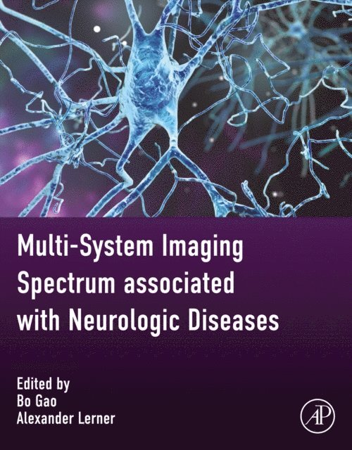 Alexander Lerner, Bo Gao - Multi-system Imaging Spectrum associated with Neurologic Diseases, E-bok