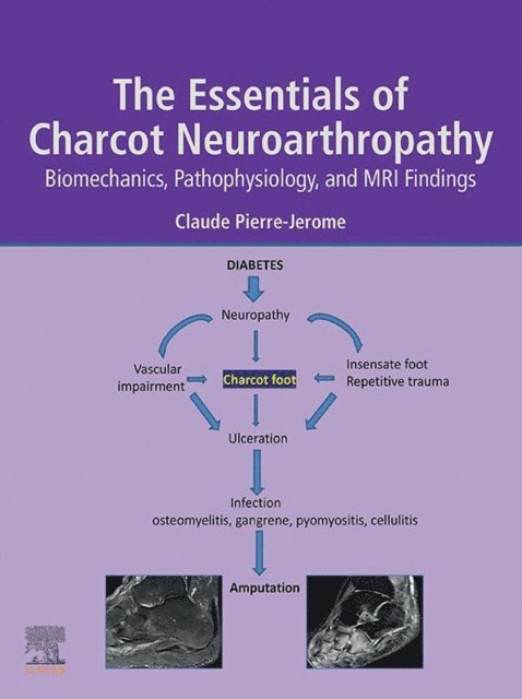 Claude Pierre-Jerome - Essentials of Charcot Neuroarthropathy, E-bok
