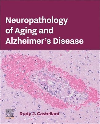 Rudy J. Castellani - Neuropathology of Aging and Alzheimer's Disease, Häftad